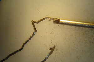 catena conoide21