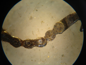 catena conoide5